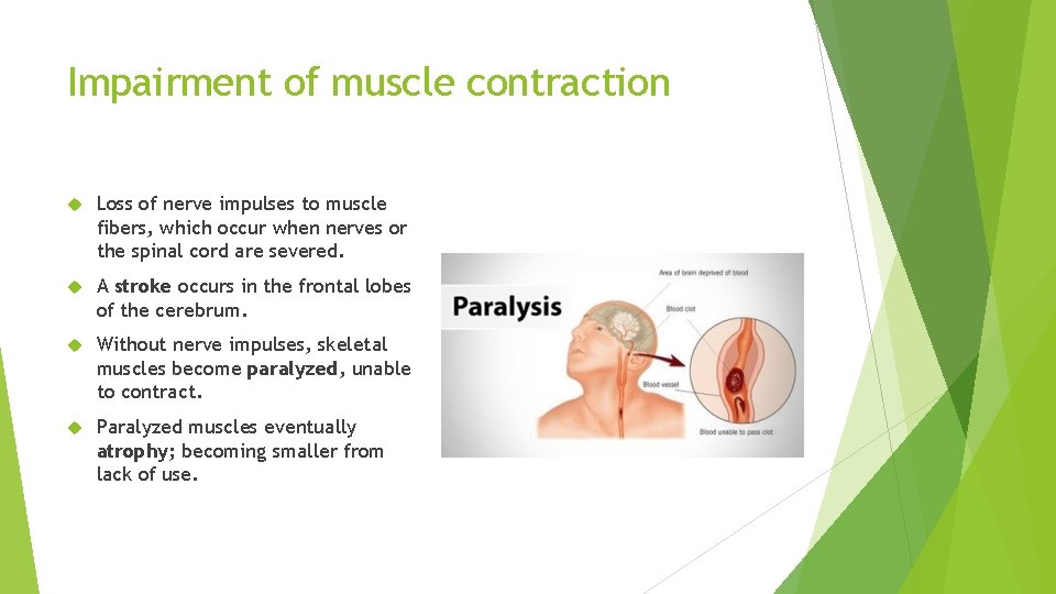Impairment of muscle contraction Loss of nerve impulses to muscle fibers, which occur when