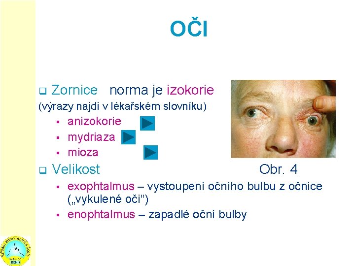 OČI q Zornice : norma je izokorie (výrazy najdi v lékařském slovníku) § §