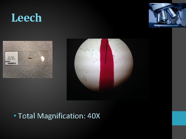 Leech • Total Magnification: 40 X 