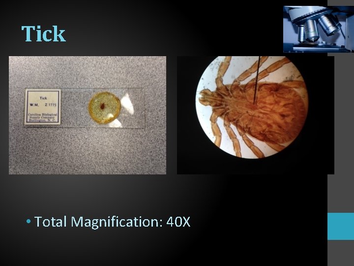 Tick • Total Magnification: 40 X 