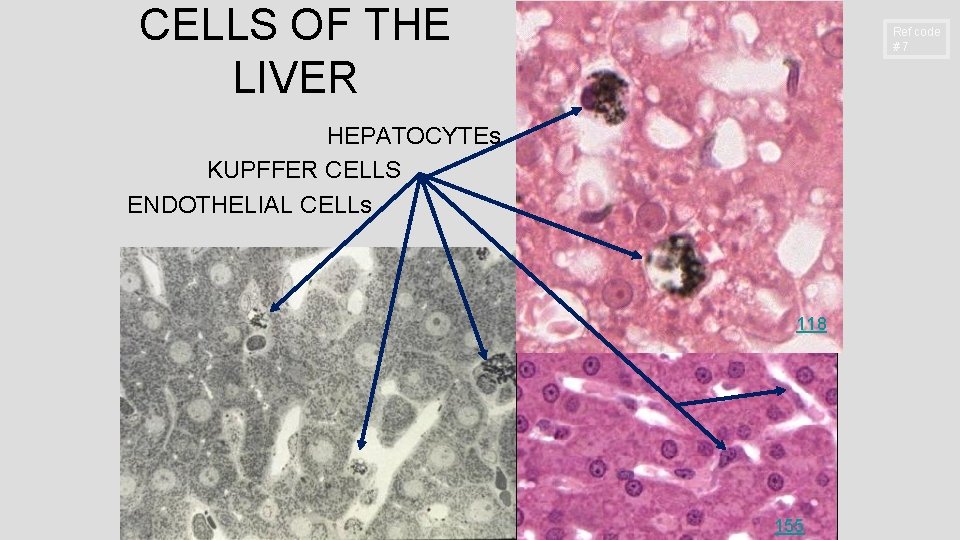 CELLS OF THE LIVER Ref code #7 HEPATOCYTEs KUPFFER CELLS ENDOTHELIAL CELLs 118 155
