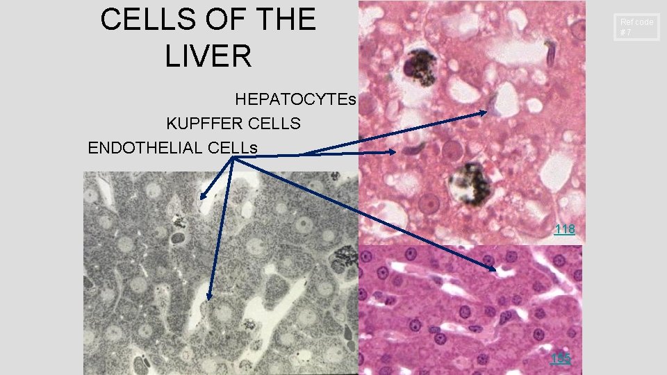 CELLS OF THE LIVER Ref code #7 HEPATOCYTEs KUPFFER CELLS ENDOTHELIAL CELLs 118 155