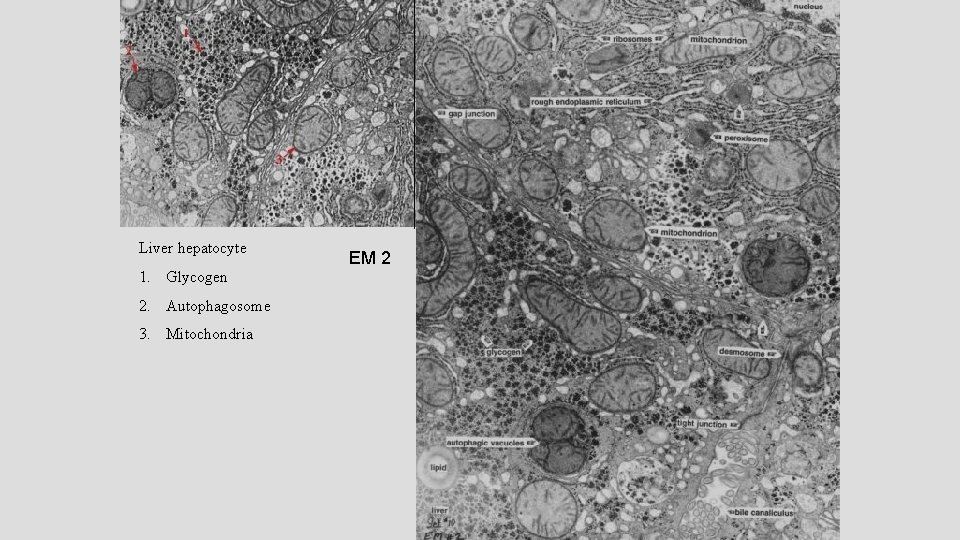 Liver hepatocyte 1. Glycogen 2. Autophagosome 3. Mitochondria EM 2 