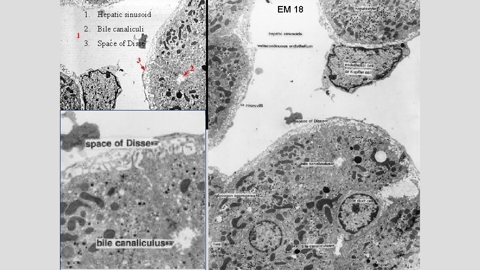 1. Hepatic sinusoid 2. Bile canaliculi 3. Space of Disse EM 18 