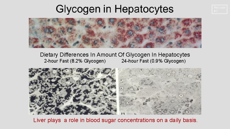 Ref code #7 Dietary Differences In Amount Of Glycogen In Hepatocytes 2 -hour Fast