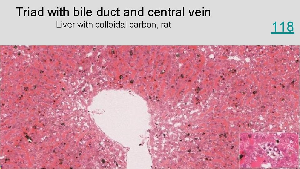 Triad with bile duct and central vein Liver with colloidal carbon, rat 118 