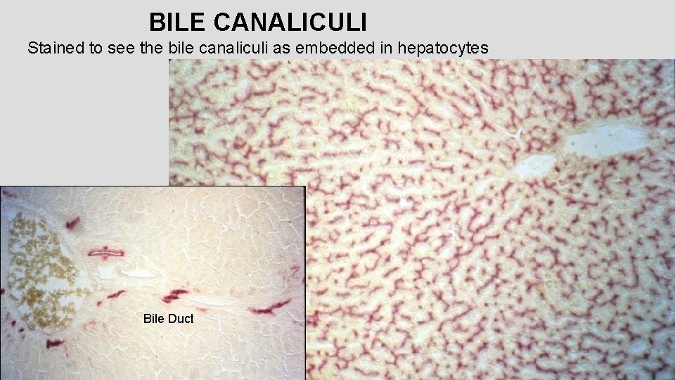 BILE CANALICULI Stained to see the bile canaliculi as embedded in hepatocytes Bile Duct