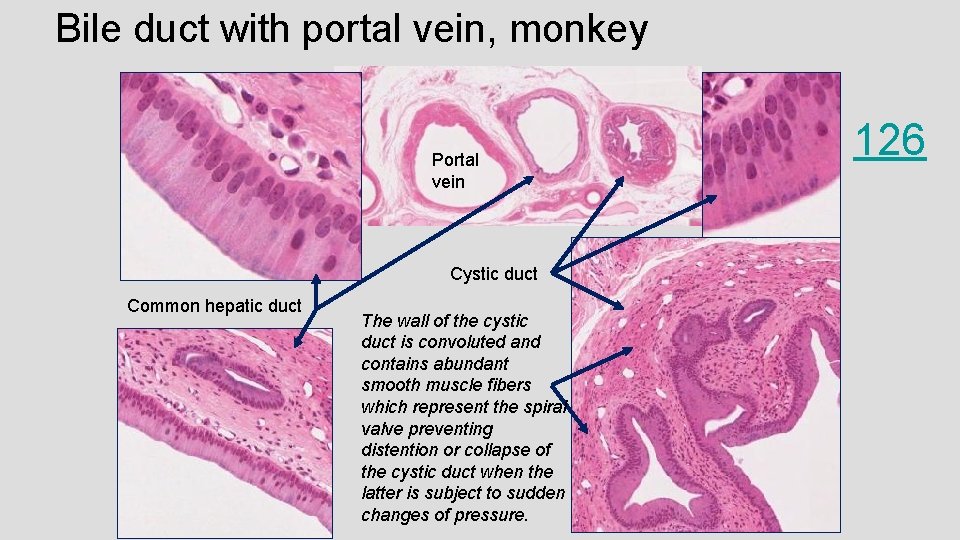 Bile duct with portal vein, monkey Portal vein Cystic duct Common hepatic duct The