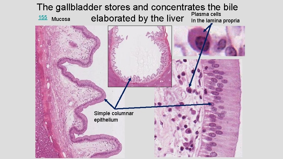 The gallbladder stores and concentrates the bile Plasma cells 155 Mucosa elaborated by the