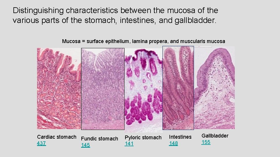 Distinguishing characteristics between the mucosa of the various parts of the stomach, intestines, and