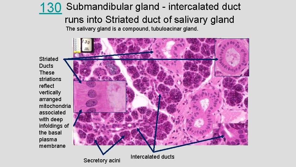130 Submandibular gland - intercalated duct runs into Striated duct of salivary gland The