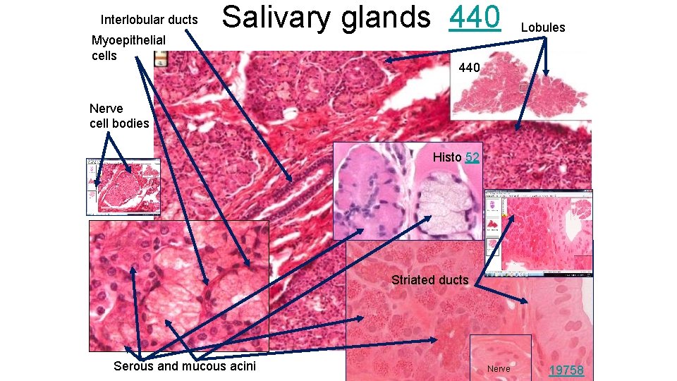 Interlobular ducts Myoepithelial cells Salivary glands 440 Lobules 440 Nerve cell bodies Histo 52
