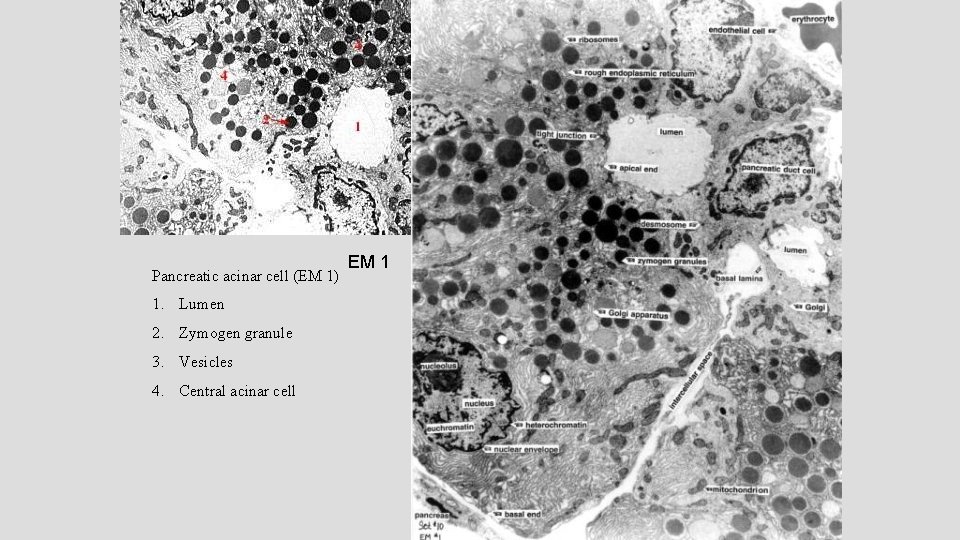 Pancreatic acinar cell (EM 1) 1. Lumen 2. Zymogen granule 3. Vesicles 4. Central