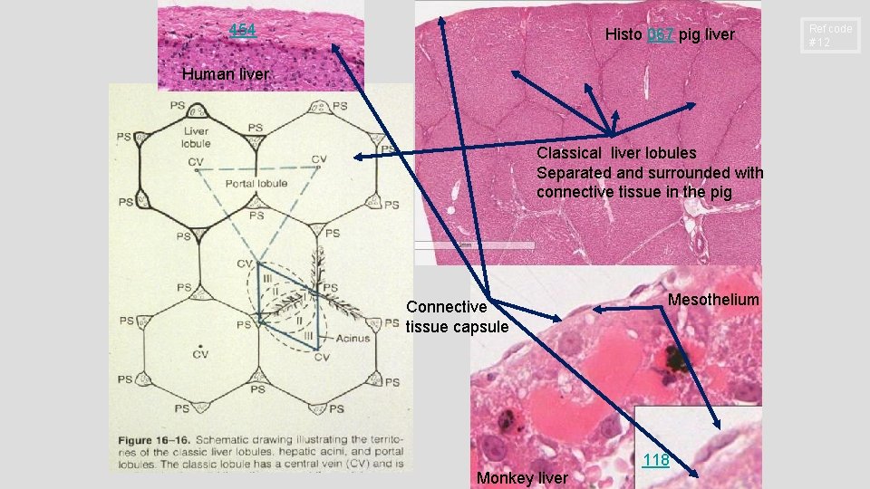454 Histo 067 pig liver Human liver Classical liver lobules Separated and surrounded with