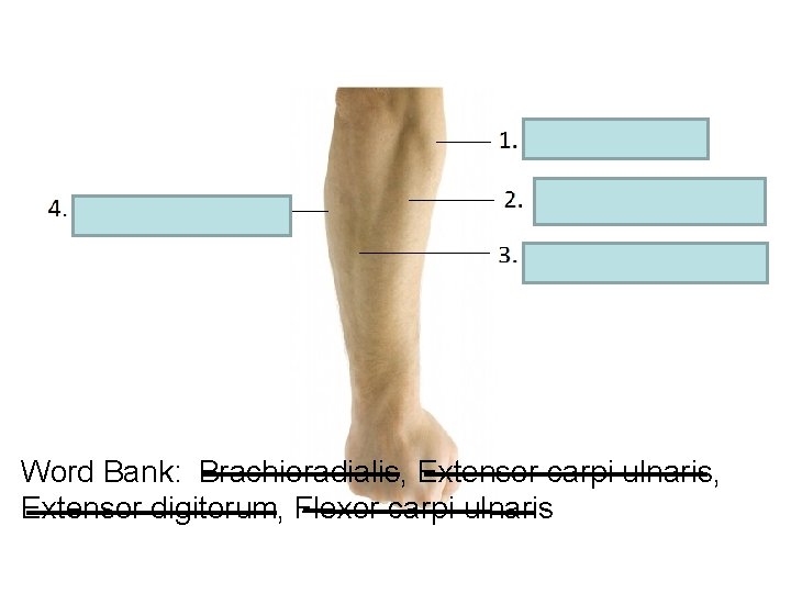 Word Bank: Brachioradialis, Extensor carpi ulnaris, Extensor digitorum, Flexor carpi ulnaris 