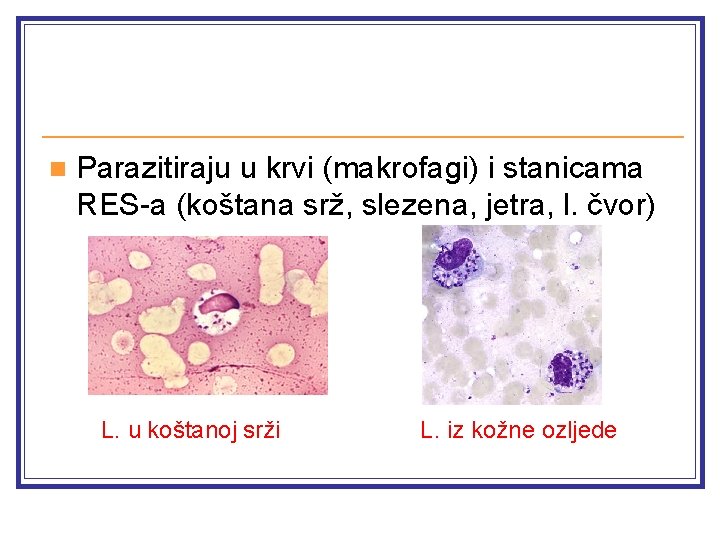 n Parazitiraju u krvi (makrofagi) i stanicama RES-a (koštana srž, slezena, jetra, l. čvor)