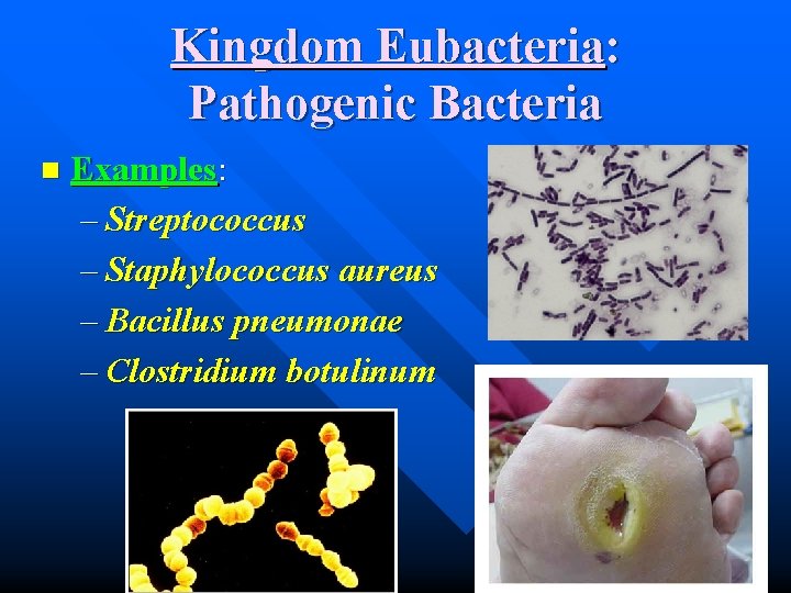 Kingdom Eubacteria: Pathogenic Bacteria n Examples: – Streptococcus – Staphylococcus aureus – Bacillus pneumonae