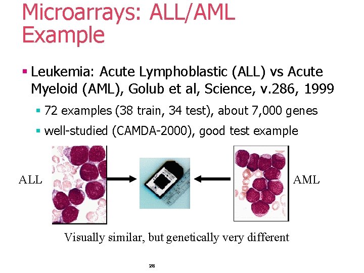 Microarrays: ALL/AML Example § Leukemia: Acute Lymphoblastic (ALL) vs Acute Myeloid (AML), Golub et Microarrays: ALL/AML Example § Leukemia: Acute Lymphoblastic (ALL) vs Acute Myeloid (AML), Golub et