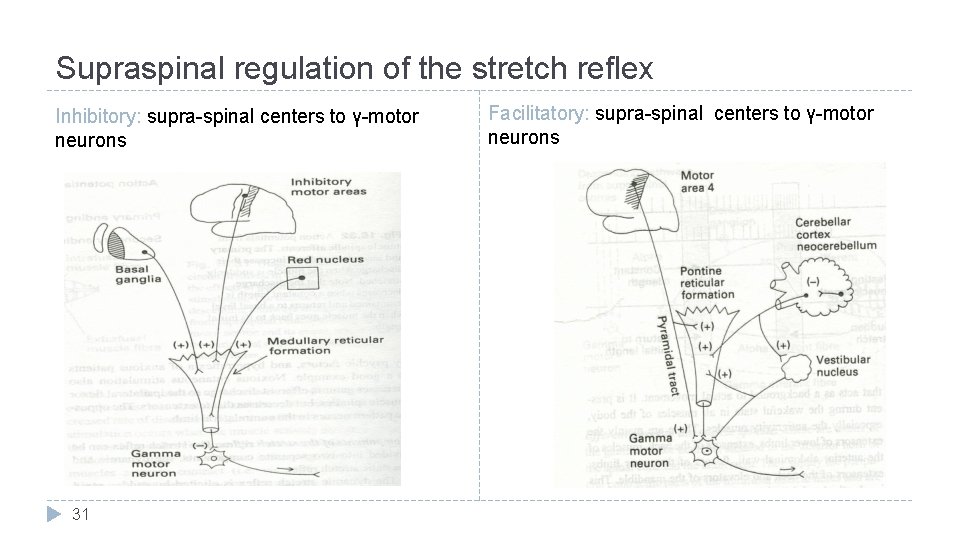 Supraspinal regulation of the stretch reflex Inhibitory: supra-spinal centers to γ-motor neurons 31 Facilitatory: