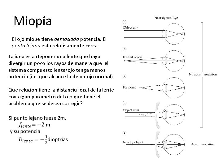 Miopía El ojo miope tiene demasiada potencia. El punto lejano esta relativamente cerca. La