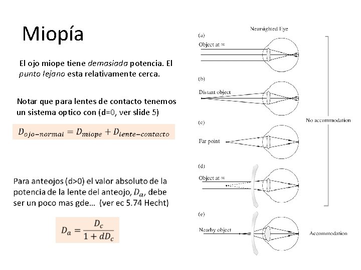 Miopía El ojo miope tiene demasiada potencia. El punto lejano esta relativamente cerca. Notar