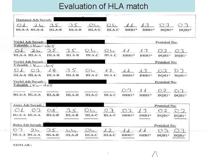 Evaluation of HLA match 