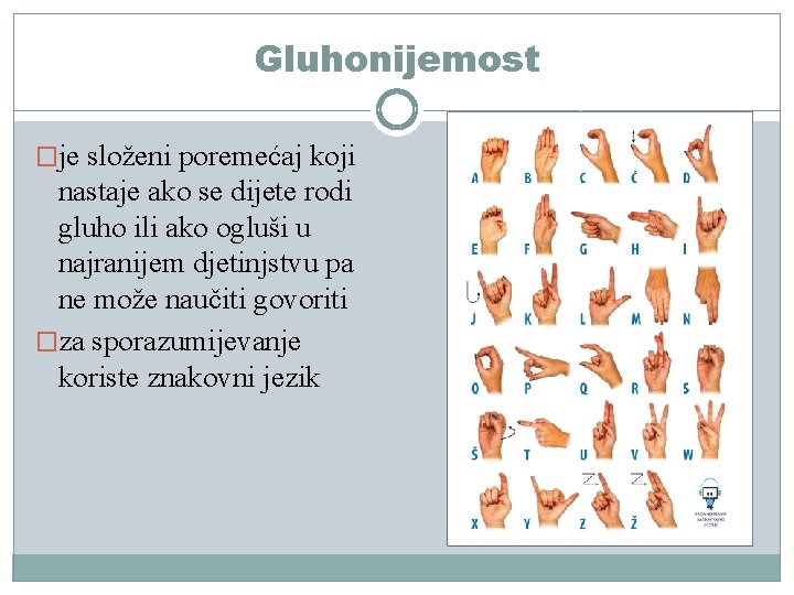 Gluhonijemost �je složeni poremećaj koji nastaje ako se dijete rodi gluho ili ako ogluši