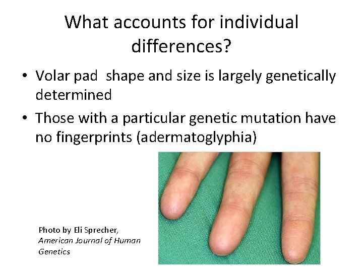 What accounts for individual differences? • Volar pad shape and size is largely genetically