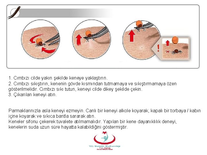 1. Cımbızı cilde yakın şekilde keneye yaklaştırın. 2. Cımbızı sıkıştırın, kenenin gövde kısmından tutmamaya