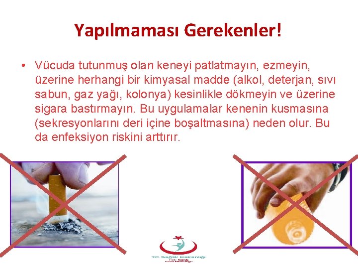 Yapılmaması Gerekenler! • Vücuda tutunmuş olan keneyi patlatmayın, ezmeyin, üzerine herhangi bir kimyasal madde