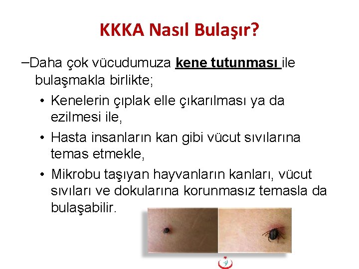 KKKA Nasıl Bulaşır? –Daha çok vücudumuza kene tutunması ile bulaşmakla birlikte; • Kenelerin çıplak