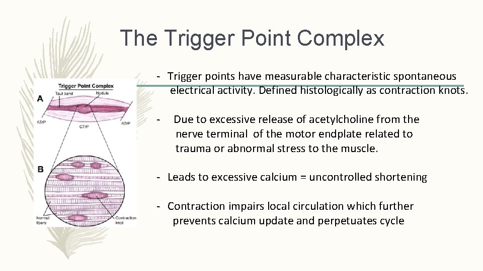 The Trigger Point Complex - Trigger points have measurable characteristic spontaneous electrical activity. Defined The Trigger Point Complex - Trigger points have measurable characteristic spontaneous electrical activity. Defined