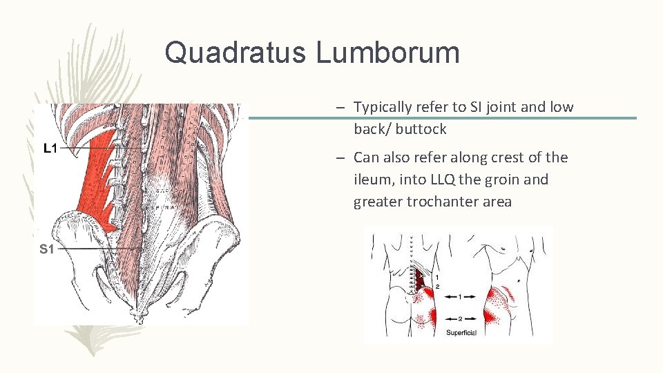 Quadratus Lumborum – Typically refer to SI joint and low back/ buttock – Can Quadratus Lumborum – Typically refer to SI joint and low back/ buttock – Can