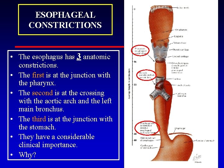 ESOPHAGEAL CONSTRICTIONS • The esophagus has 3 anatomic constrictions. • The first is at