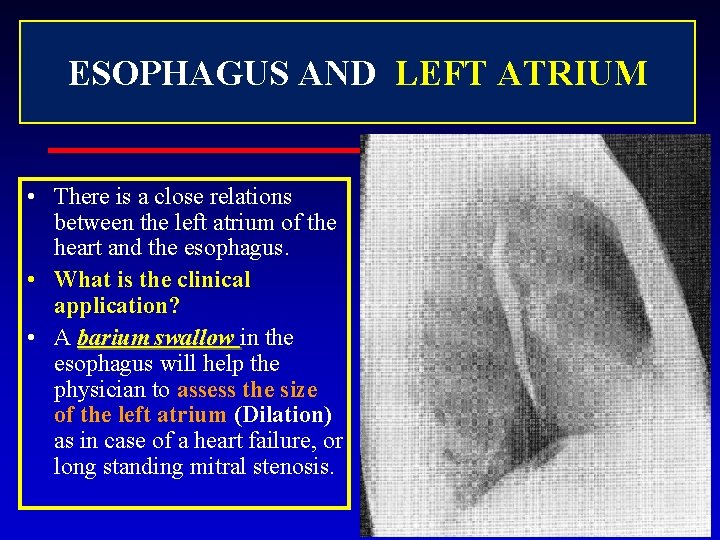 ESOPHAGUS AND LEFT ATRIUM • There is a close relations between the left atrium