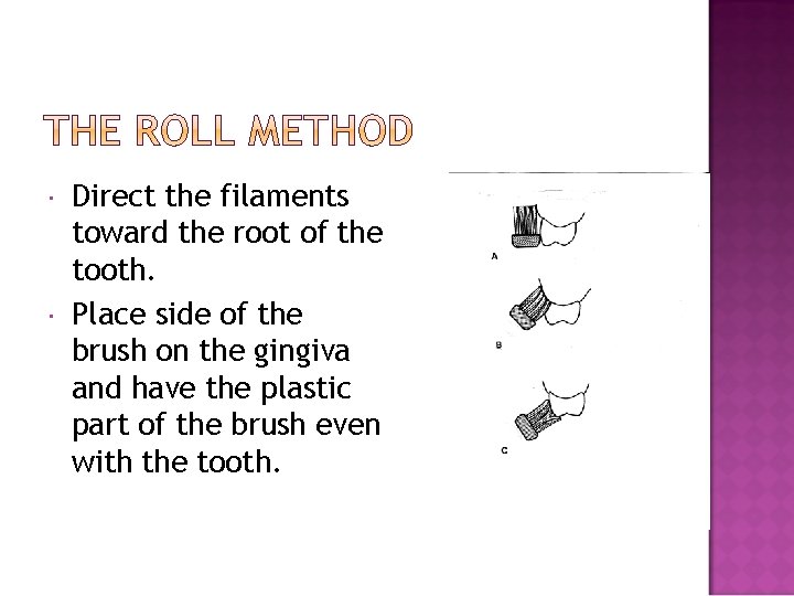  Direct the filaments toward the root of the tooth. Place side of the