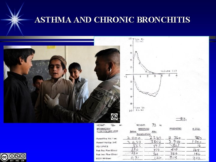 ASTHMA AND CHRONIC BRONCHITIS 