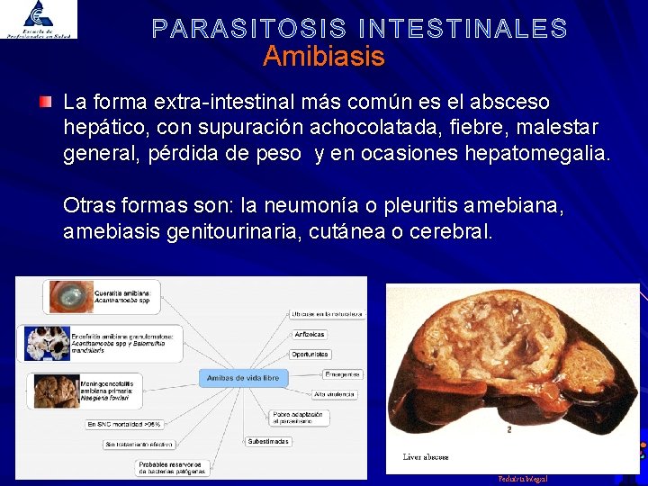 Amibiasis La forma extra-intestinal más común es el absceso hepático, con supuración achocolatada, fiebre,