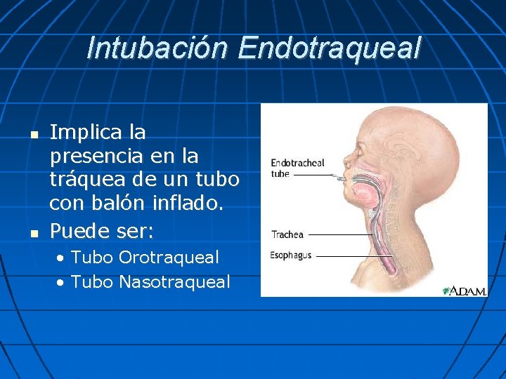 Intubación Endotraqueal Implica la presencia en la tráquea de un tubo con balón inflado.
