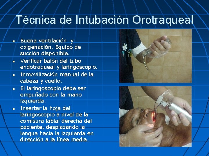 Técnica de Intubación Orotraqueal Buena ventilación y oxigenación. Equipo de succión disponible. Verificar balón