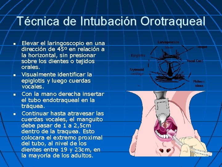 Técnica de Intubación Orotraqueal Elevar el laringoscopio en una dirección de 45º en relación