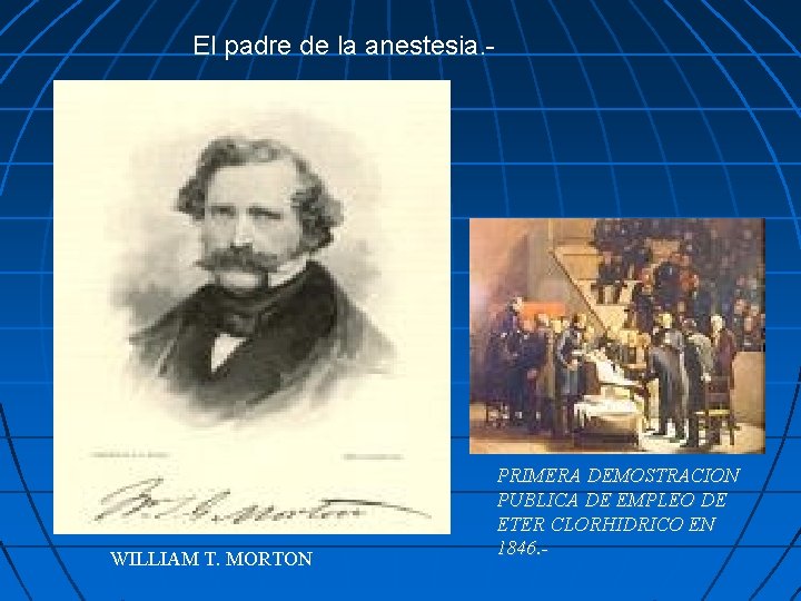 El padre de la anestesia. - WILLIAM T. MORTON PRIMERA DEMOSTRACION PUBLICA DE EMPLEO