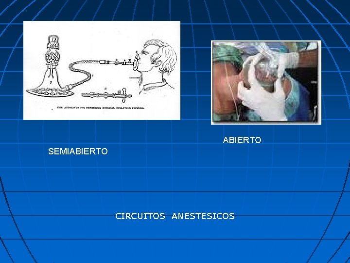 ABIERTO SEMIABIERTO CIRCUITOS ANESTESICOS 