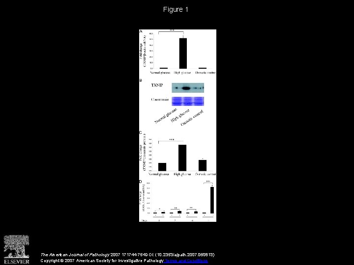 Figure 1 The American Journal of Pathology 2007 171744 -754 DOI: (10. 2353/ajpath. 2007.