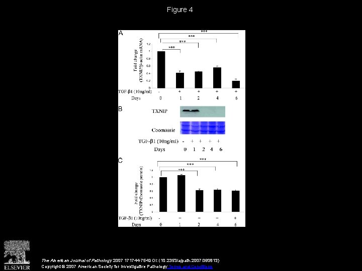 Figure 4 The American Journal of Pathology 2007 171744 -754 DOI: (10. 2353/ajpath. 2007.