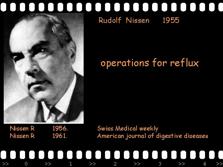 Rudolf Nissen 1955 operations for reflux Nissen R >> 0 1956. 1961. >> Swiss