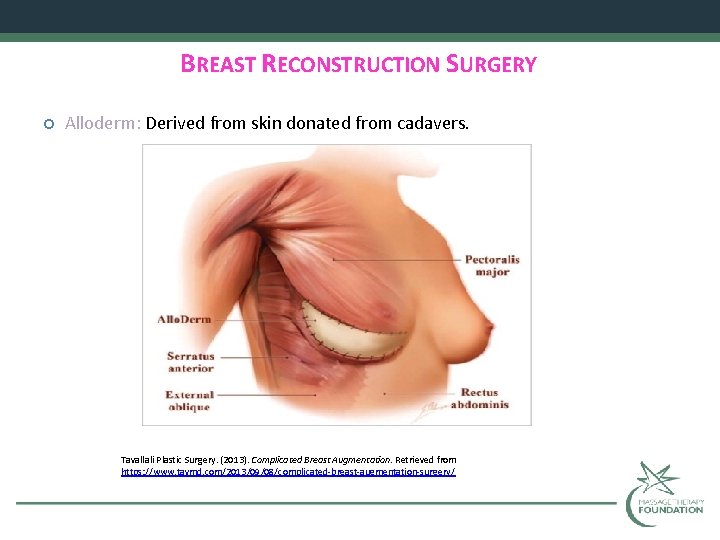 BREAST RECONSTRUCTION SURGERY Alloderm: Derived from skin donated from cadavers. Tavallali Plastic Surgery. (2013).