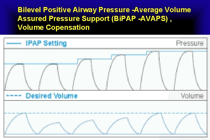 Bilevel Positive Airway Pressure -Average Volume Assured Pressure Support (Bi. PAP -AVAPS) , Volume
