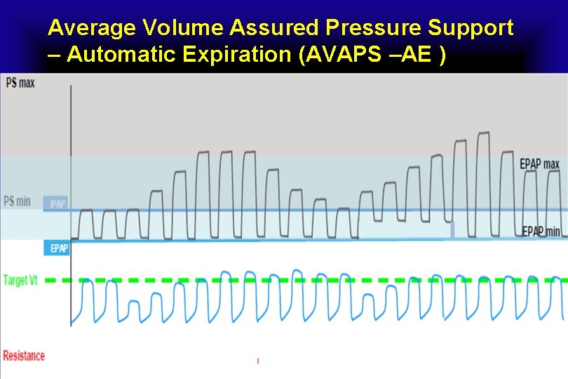 Average Volume Assured Pressure Support – Automatic Expiration (AVAPS –AE ) 