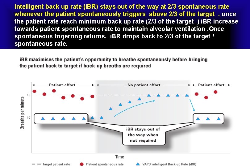 Intelligent back up rate (i. BR) stays out of the way at 2/3 spontaneous